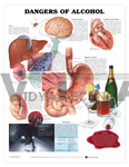 Dangers of Alcohol Anatomical Chart, 1st Edition - Styrene Plastic